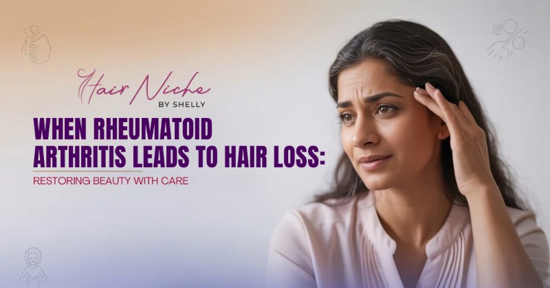 When Rheumatoid Arthritis Leads to Hair Loss: Restoring Beauty With Care