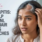 Tinea Capitis: The Scalp Infection Behind Hair Thinning and Patches