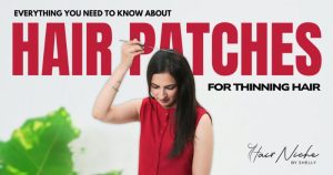 Read more about the article Everything You Need to Know About Hair Patches for Thinning Hair (2026 Guide)